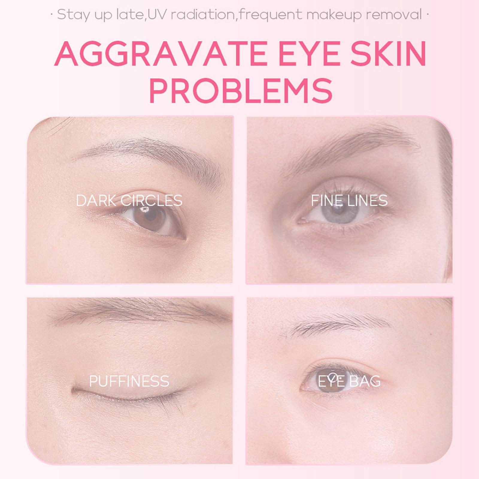 1/3/5pcs Sakura Eye Essence cr - Women Bags Under Eyes ulasan dan harga