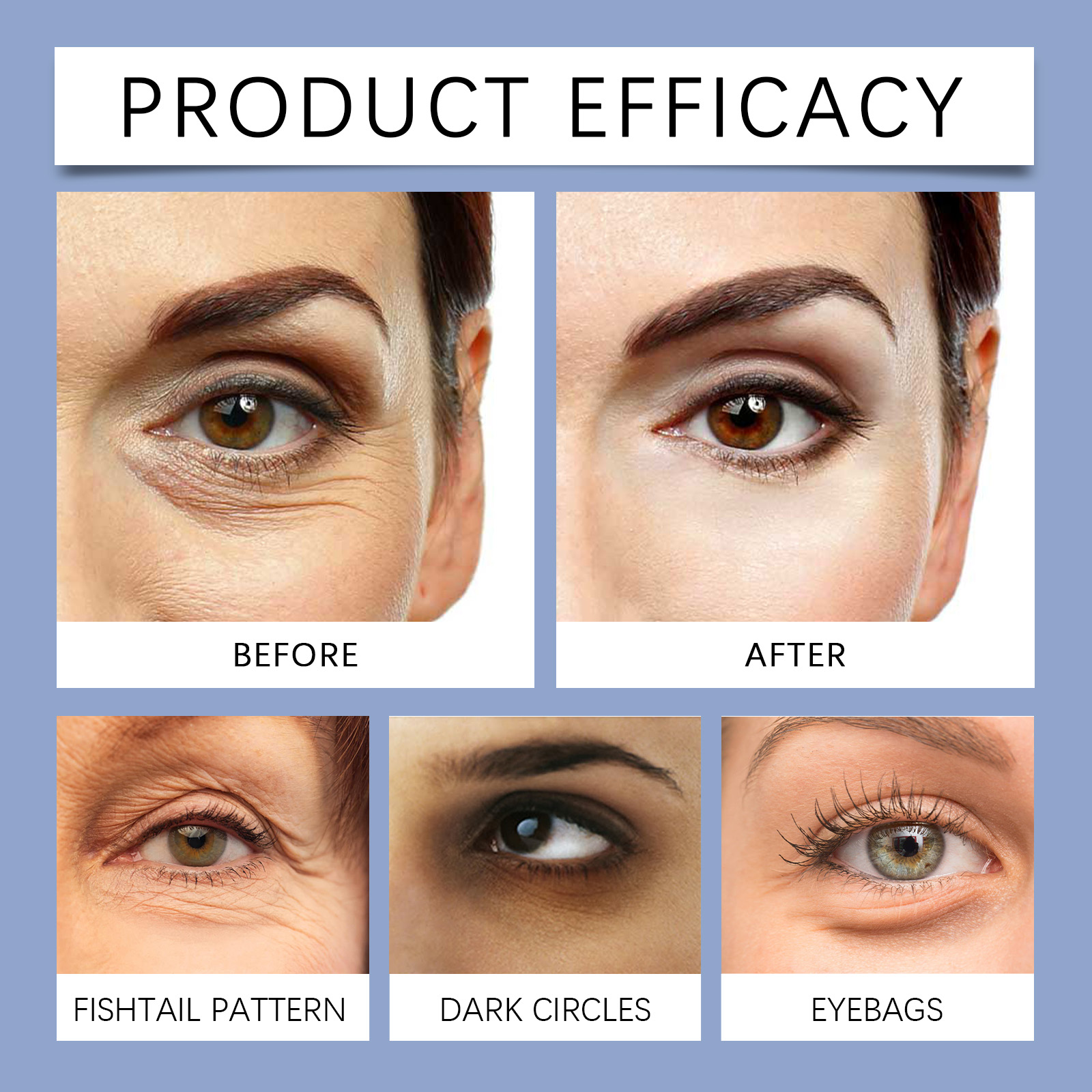 EELHOE Retinol Microneedle Eye - Women Bags Under Eyes ulasan dan harga